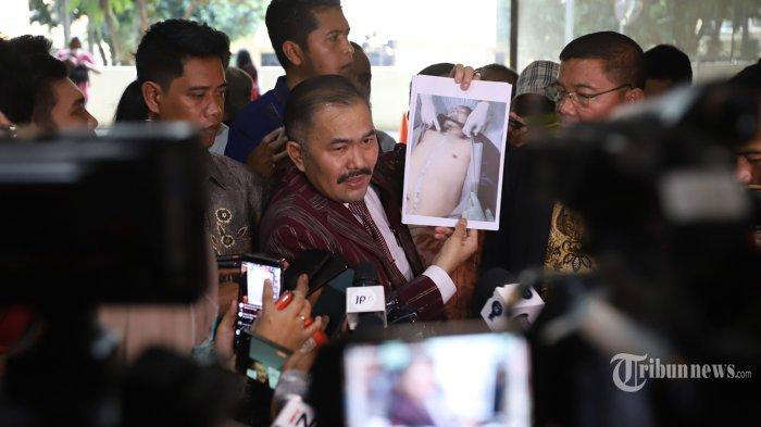 Polri Belum Menetapkan Tersangka, Kuasa Hukum Keluarga Brigadir J Ungkap JIka ada Ancaman Pembunuhan Sejak Juni